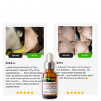 Whitening Serum: Perfect Skin Booster